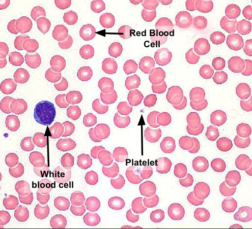 <p>a type of FLUID connective tissue made of PLASMA, PLATELETS, RED, and WHITE BLOOD CELLS&nbsp;</p><ul><li><p>transports oxygen and nutrients around the body/ carries O2&nbsp;</p></li></ul><p></p>
