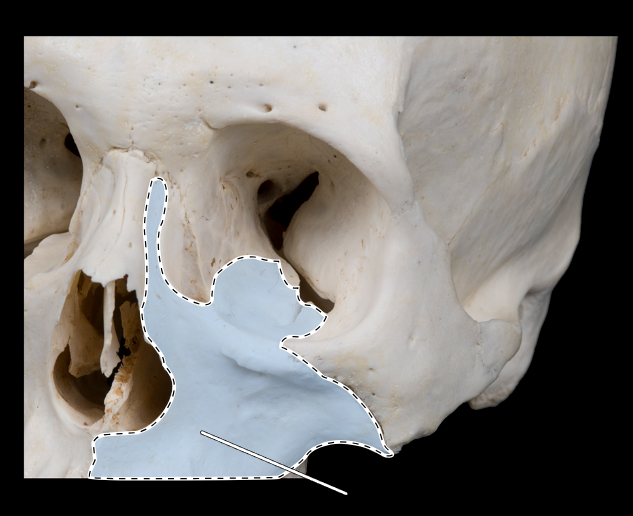 <p>Name this bone.</p><p>(Bones that form the orbit).</p>