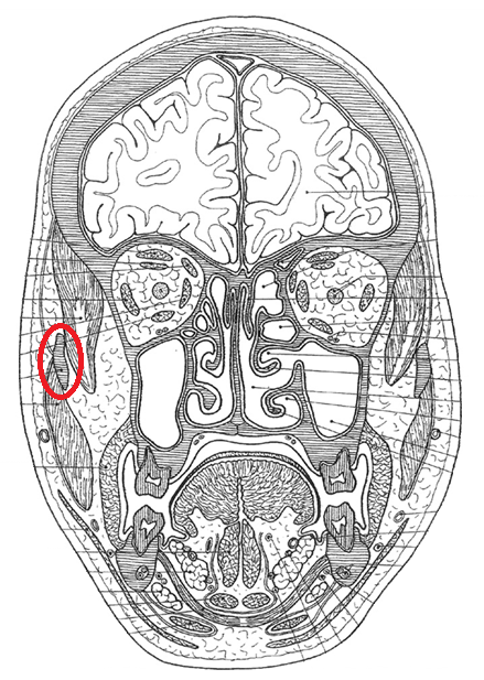 term image
