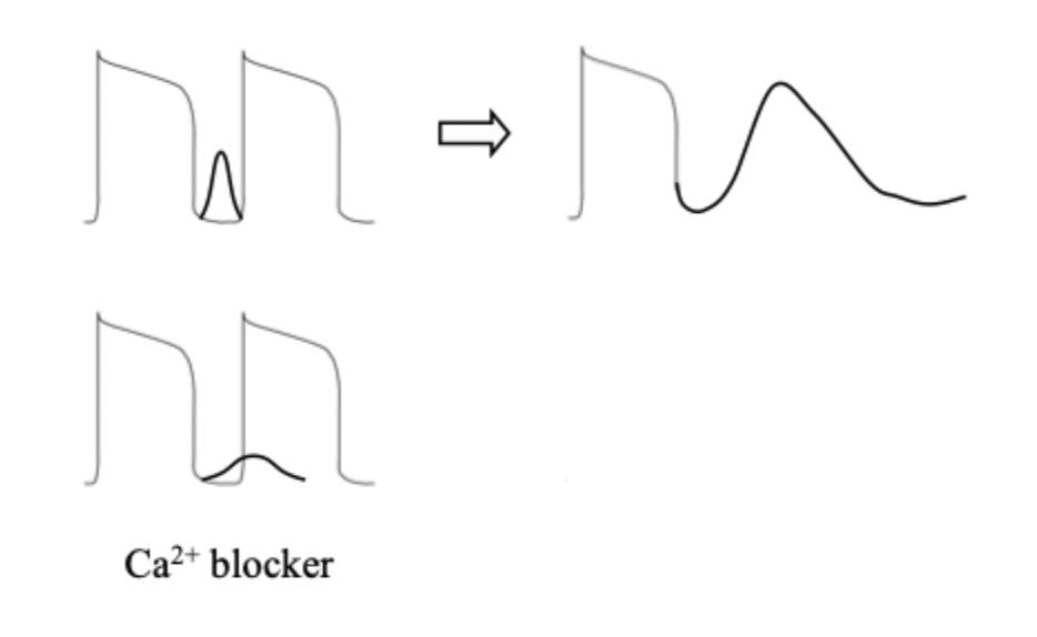 <p>(1) DAD treatment using a<strong> Ca2+ blocker</strong></p><p>(2)<strong> 2 AP</strong></p><p>(3)<strong> 1 beat</strong>.</p><img src="https://knowt-user-attachments.s3.amazonaws.com/6908b803-5414-4151-89d3-4aed72379111.png" data-width="100%" data-align="center"><p></p>