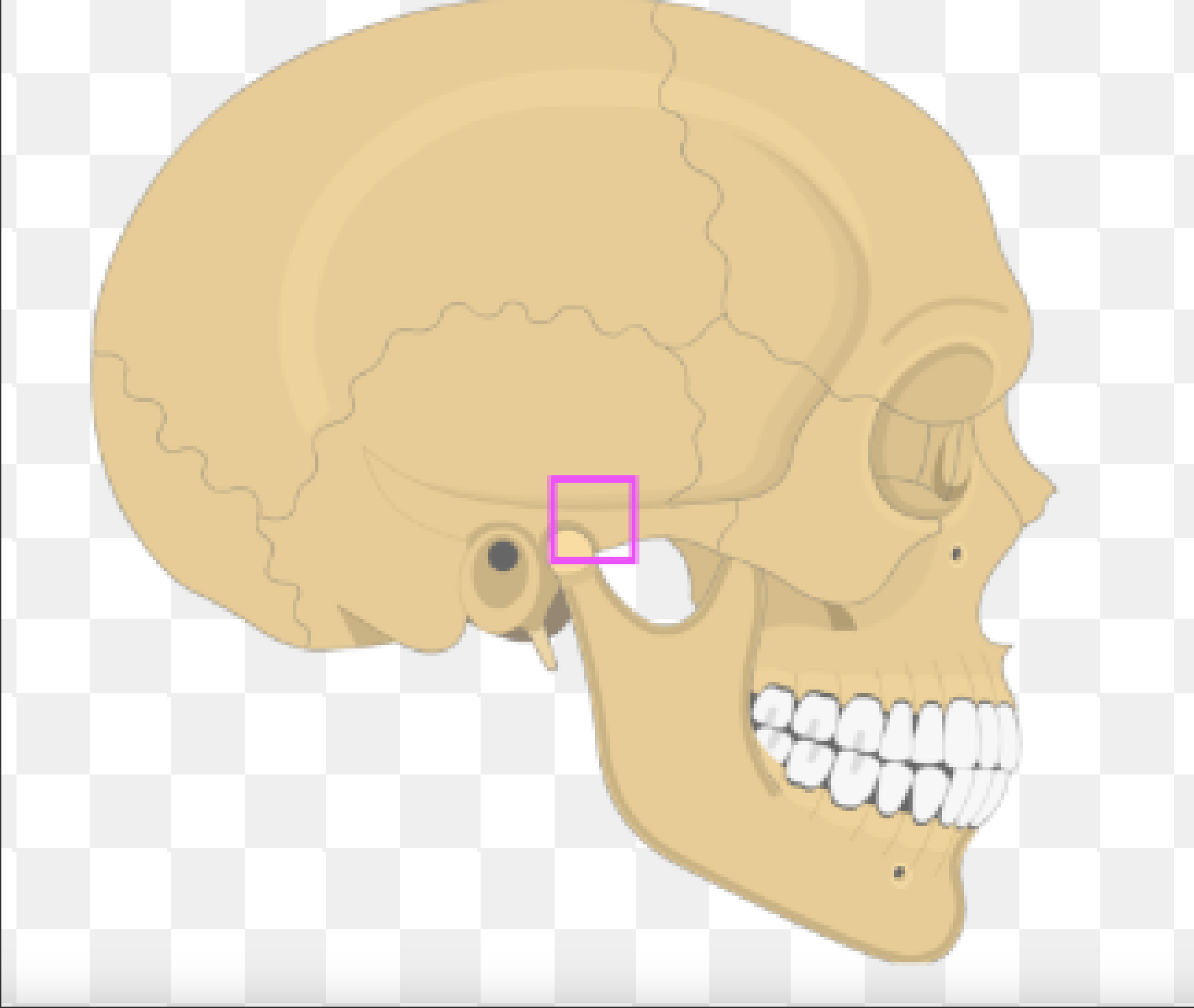 <p>What bone marking is this?</p>