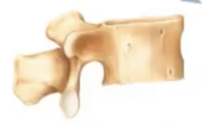 <p><span>complex shape, vary in amount of spongy and compact bone tissue, ex. vertebrae</span></p>