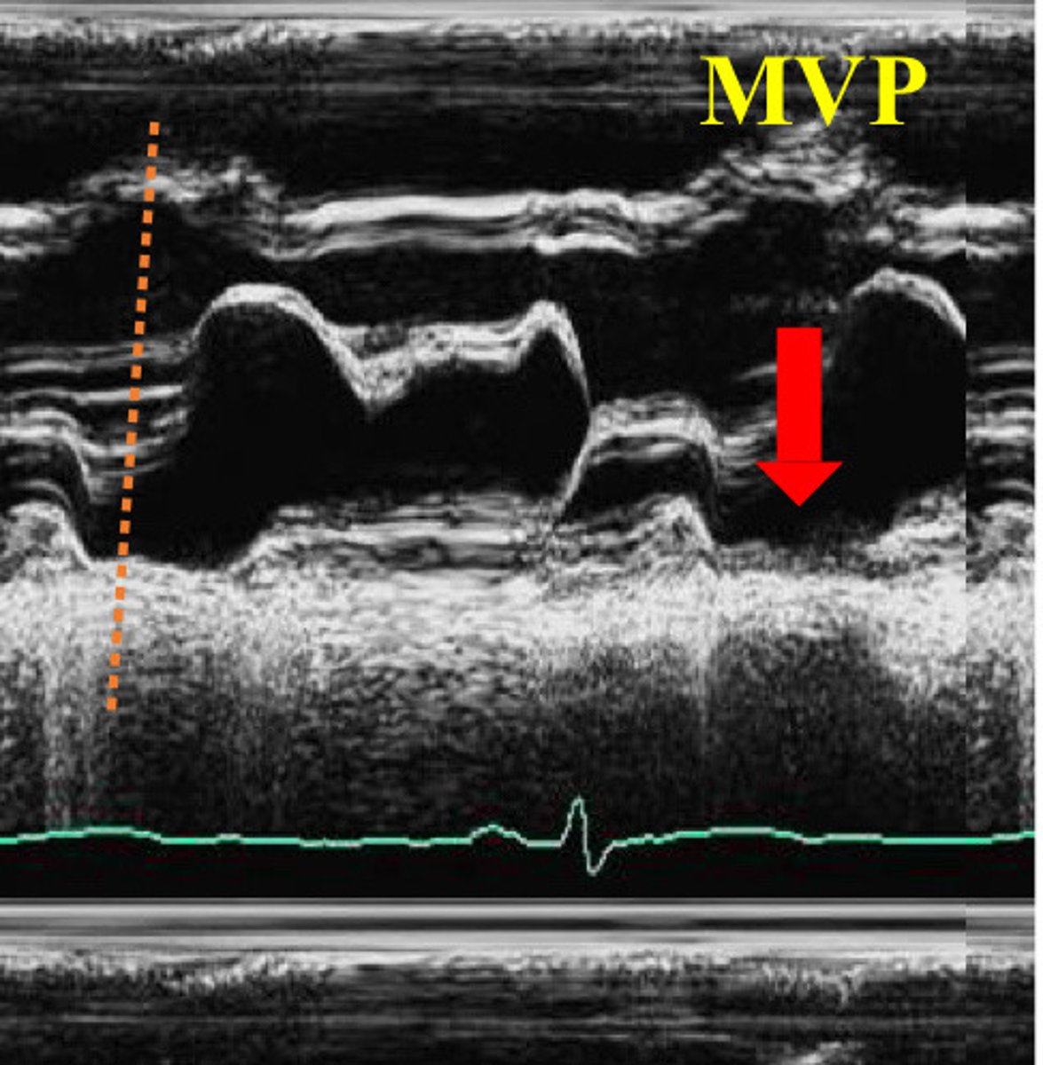 <p>Describe the findings of this image</p>