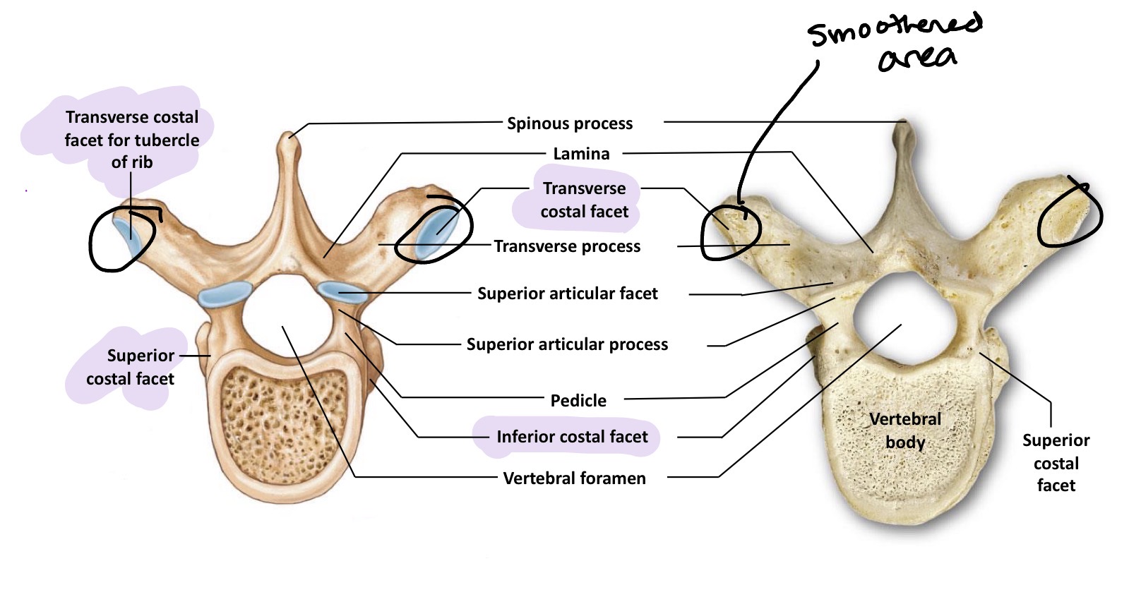<p>Twelve vertebrae that articulate with the ribs (rib per vertebrae ) and muscles and movement associated with respiration. Medium size and increase in size as they move down the back. They lack transverse foramina and bifid spinous processes</p>