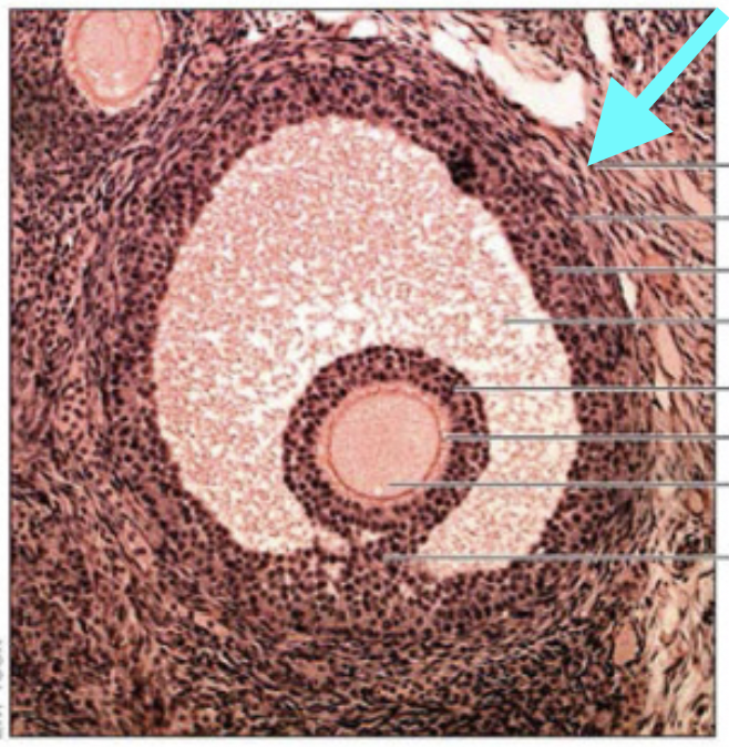 <p>What structure is shown (at arrow)?</p>