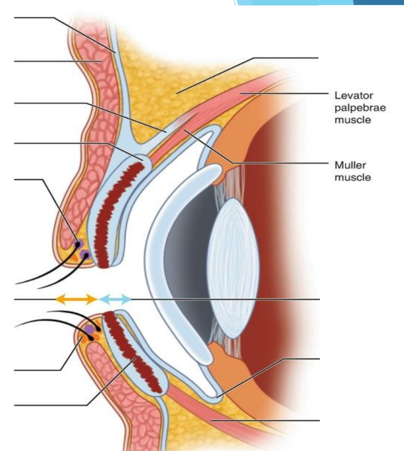 <p>Constists of the <u>palpebral muscle of muller</u></p><p>Inserted on the peripheral margins of the tarsal plate</p><p>CN III innervation</p>