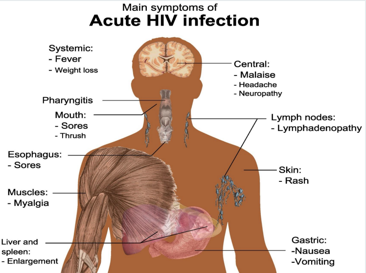<ul><li><p>fever </p></li><li><p>malaise</p></li><li><p>sores in mouth/oesophagus</p></li><li><p>thrush </p></li><li><p>myalgia</p></li><li><p>neuropathy </p></li><li><p>vomiting/nausea </p></li></ul><p></p>