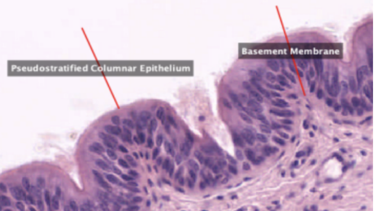 <p>What organ specimen is shown in this slide?</p>