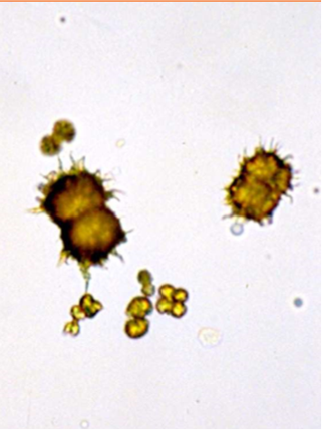 <p>Name the crystal</p>