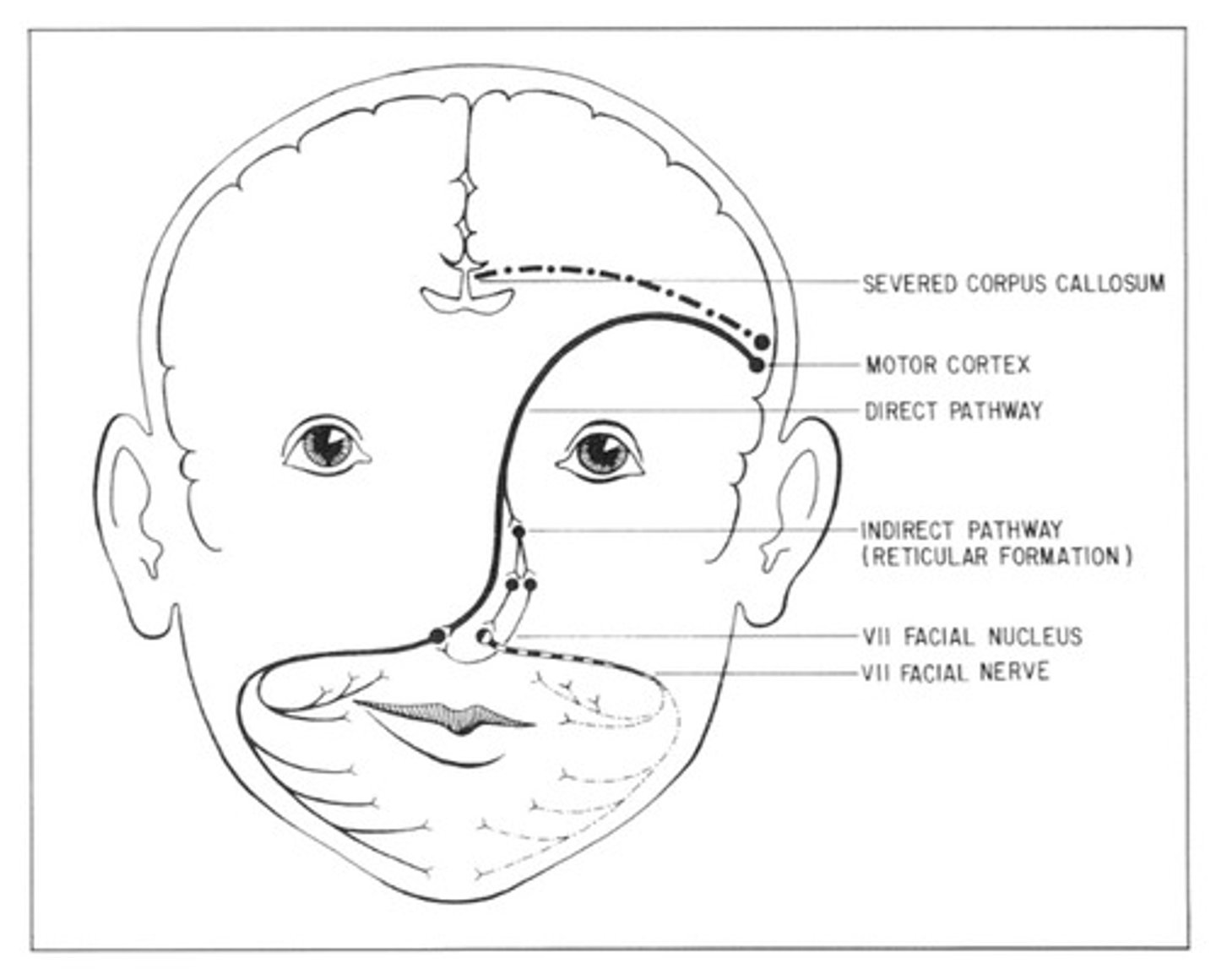 <p>LH produces voluntary facial expressions → right side of the face moves first</p>