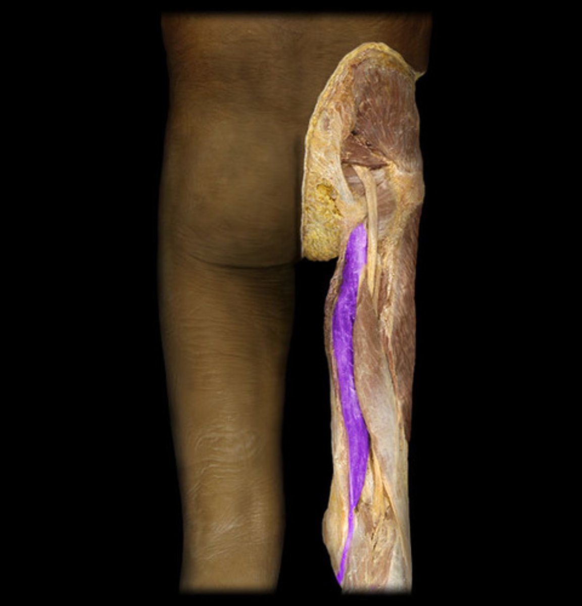 <p>Proximal attachment: Ischial tuberosity</p><p>Distal attachment: Tibia</p><p>Comments, Applications and Relationships: "To" of BTM acronym. Helpful hint- can be identified by the long distal tendon and is the middle muscle of the 3 hamstrings.</p><p>Action: Flexor of the leg at the knee</p>