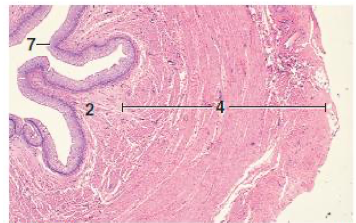 <p>What does number 4 represent in this histology picture?</p>