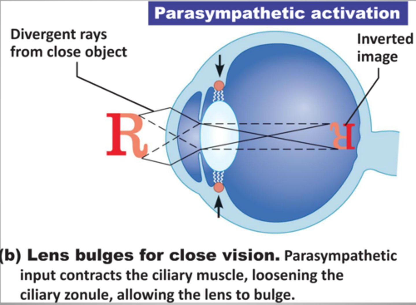 <p>-lens accommodation: change in shape (bulges) to increase refraction<br>-pupil constricts to prevent entrance of most divergent light rays<br>-medial rotation of eyeballs to converge on close object</p>