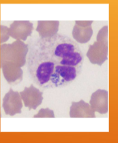 <p><span><span>Anaplasmosis</span></span></p>