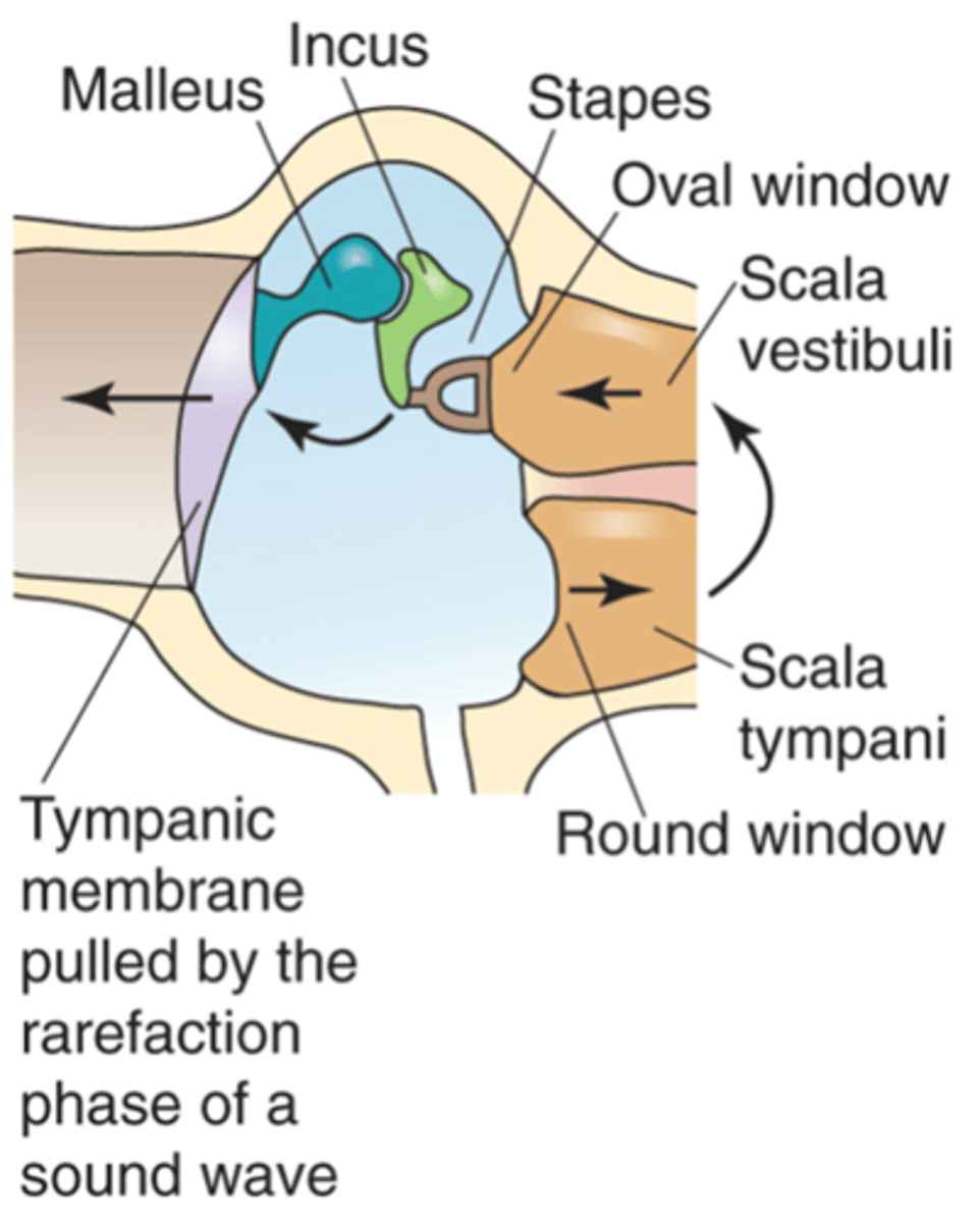 <p>If the tympanic membrane is pulled to the outside of the ear, what happens?</p>