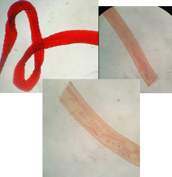 <ul><li><p>localización: ligamento nucal, ligamento gastroesplénico, corvejones. Microfilaria: sangre, piel y ganglios linfáticos subcutáneos.</p></li><li><p>Huésped intermediario: moscos hematófagos simulium y culicoides</p></li><li><p>Huésped final: bovino</p></li><li><p>ciclo indirecto</p></li><li><p>boca simple sin labios</p></li><li><p>H: cutícula gruesa en la porción media del cuerpo</p></li><li><p>M: estrías transversales en la cutícula, su extremo posterior termina en espiral, espículas.</p></li></ul>
