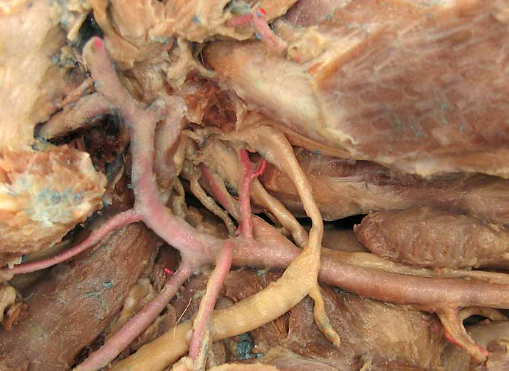 <ol start="3"><li><p>occipital artery: branch of ECA, right next to ICA, supplies meninges &amp; skull</p></li><li><p>-</p></li><li><p>lingual artery: ventral branch of ECA, supplies tonsil &amp; tongue</p></li><li><p>facial artery: branches off ECA after ^, supplies nose &amp; lips</p></li><li><p>caudal auricular artery: branch of ECA at the base of the ear</p></li><li><p>superificial temporal artery: small terminal branch of ECA, rostral to caudal auricular, supplies parotid gland &amp; temporal muscles &amp; eyelids</p></li><li><p>maxillary artery: larger terminal branch of ECA, supplies blood to head</p></li><li><p>-</p></li><li><p>-</p></li><li><p>hypoglossal nerve: white not pink, ventrorostral to carotid sheath, medial to mandib saliv gland, innervates tongue muscles</p></li><li><p>medial retropharyngeal lymph node: dorsal to CCA, more cranial than thyroid gland </p></li></ol><p></p>