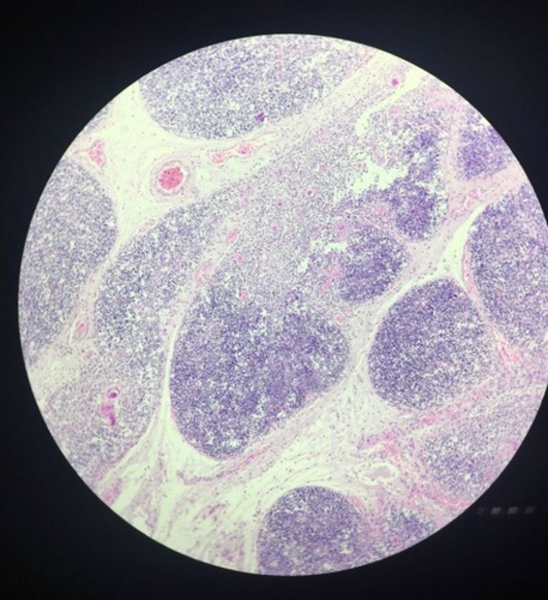 <p>Clear halo around cells (capsule) with dark background.</p>