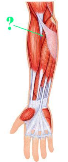 <p><span>Identify the indicated muscle.</span></p>