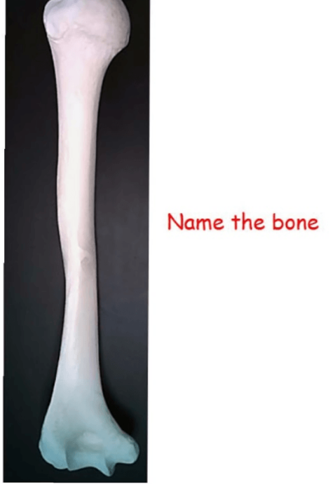 <p>name this bone</p>