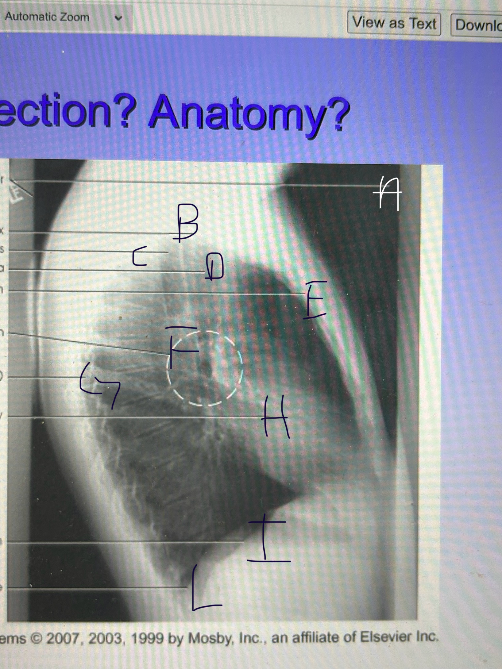 <p>label this image</p>