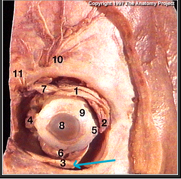 <p>What muscle?(#3)</p>
