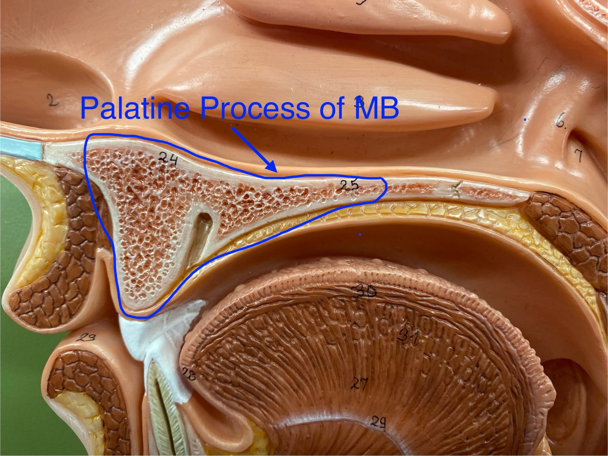 <p>a bony plate that extends from each maxilla and forms the anterior of the hard palate (roof of the mouth).</p>