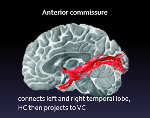 <p>it connects left and right temporal lobe/HC, then projects to visual cortex</p>