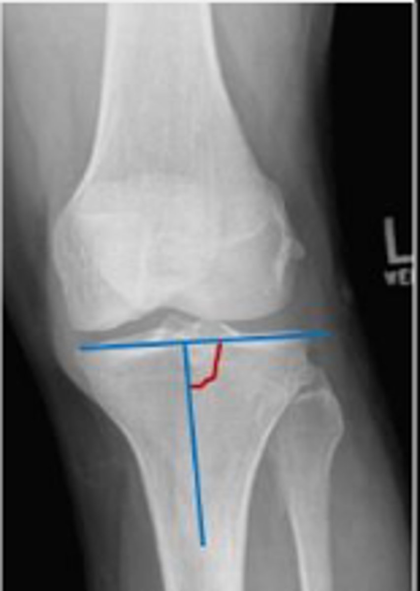 <p>What is the name of the assessment?</p>