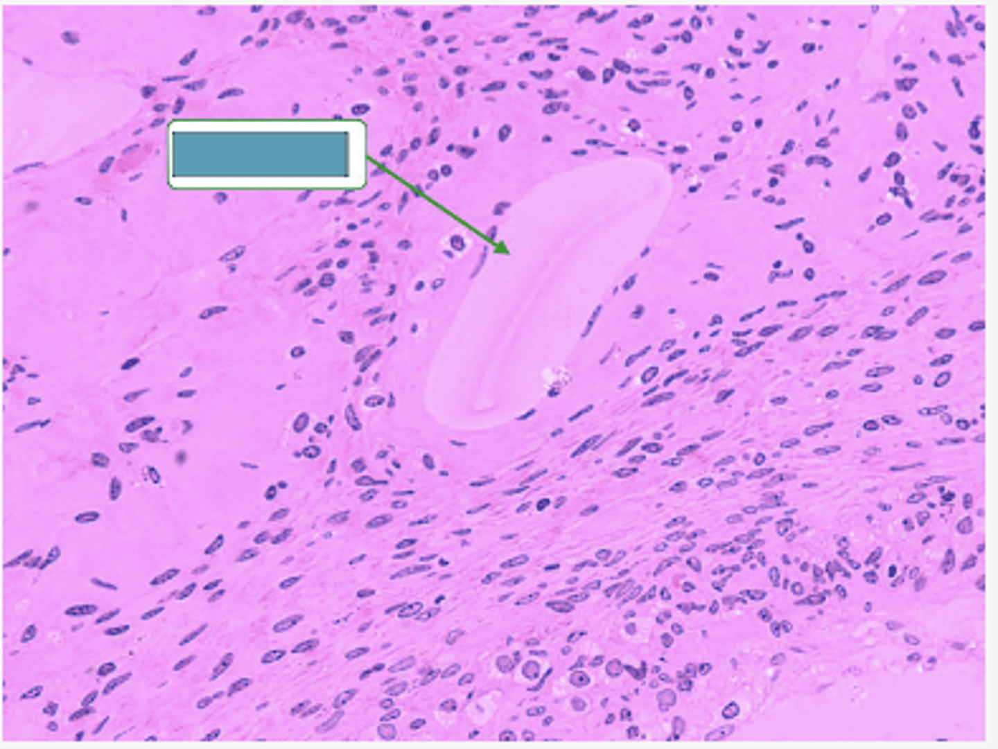 <p>Identify the structure</p>