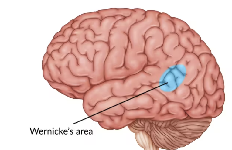 <p>Wernicke’s area </p>