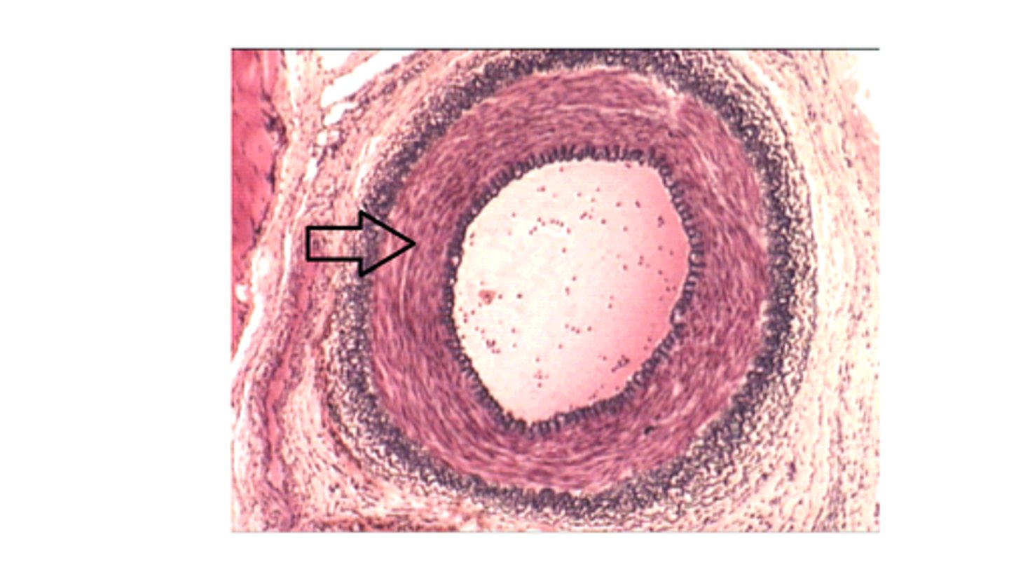 <p>The arrow is pointing at</p>