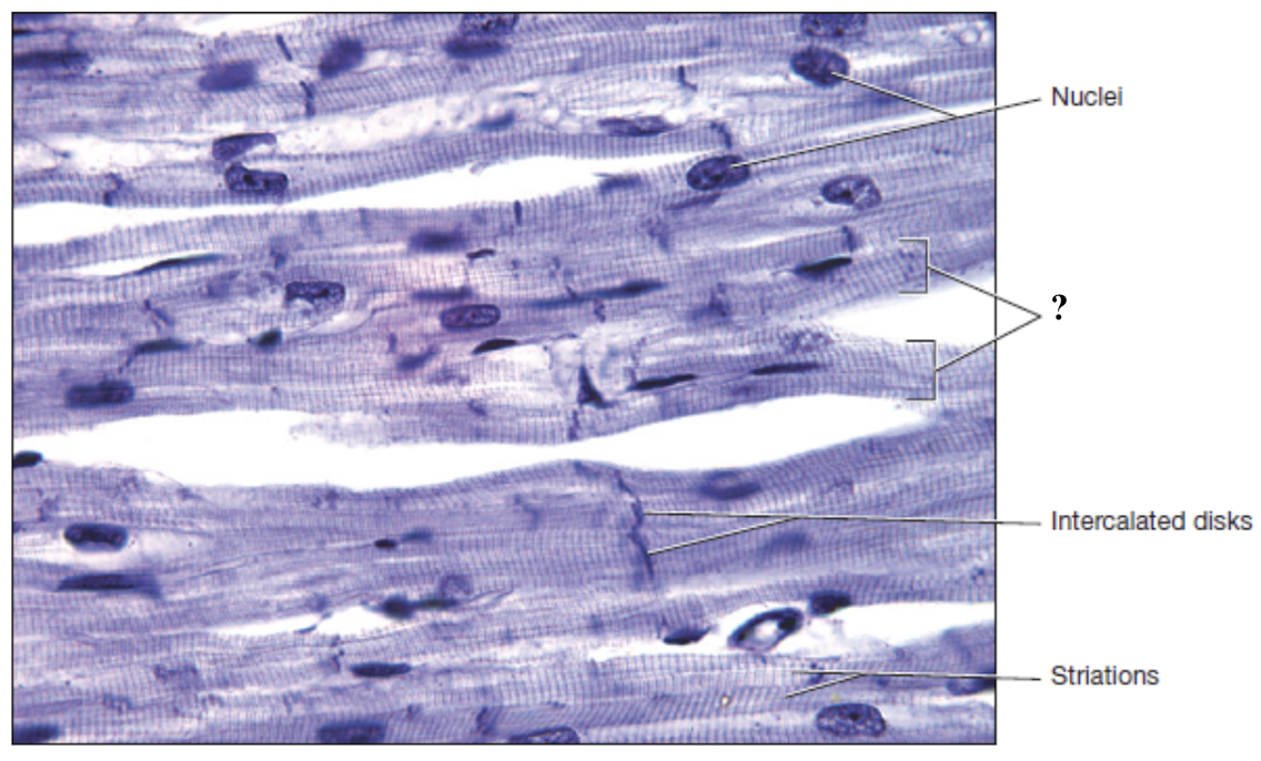 <p>cells of cardiac muscle</p>