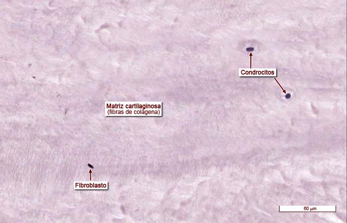 <p>TC Especializado Cartílago Fibroso (Fibrocartílago)</p><ul><li><p>No tiene pericordio</p></li><li><p>Ubicado en discos intervertevrales</p></li><li><p>Se encuentra en lugares de mucha tensión y carga en el cuerpo. </p></li></ul><p></p>