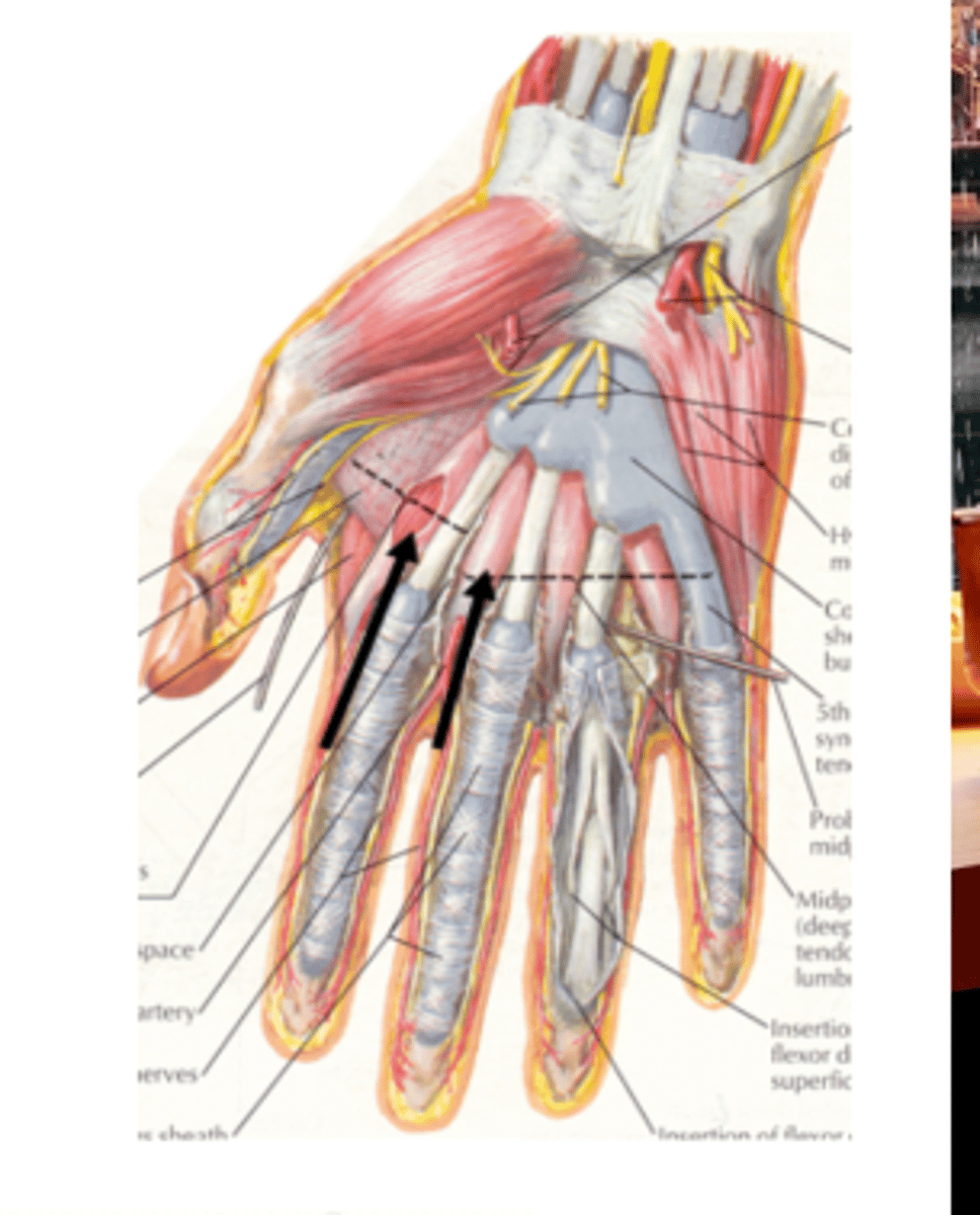 <p>distal</p>