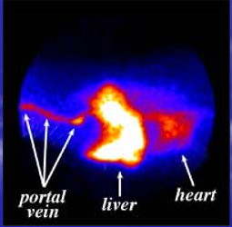 <p>Scintigraphy Case Study - Portosystemic Shunt </p><p></p><p><em>Image - Composite image of a normal dog showing the uptake of radioactive dye into the portal vein and liver&nbsp;</em></p>
