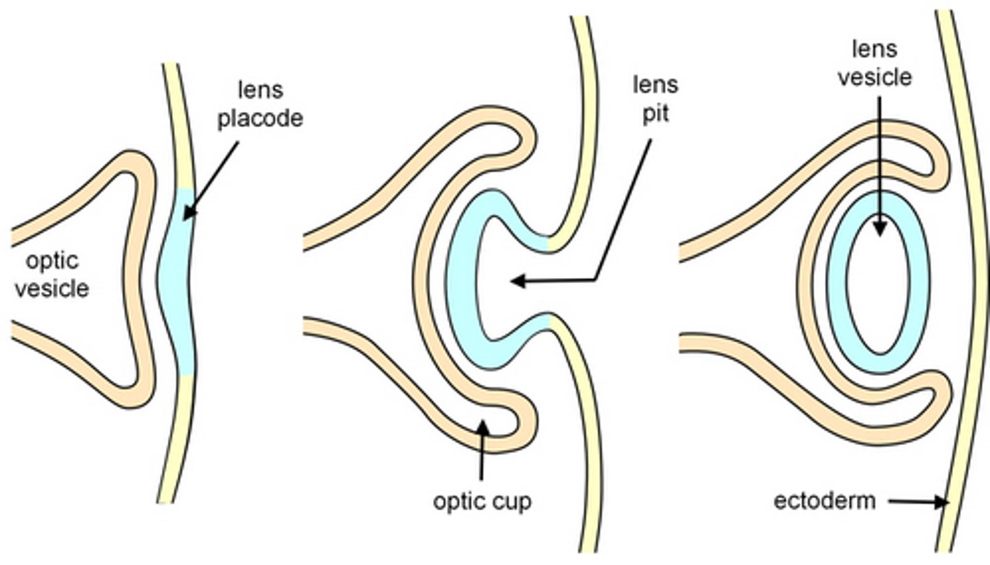 <p>Optic cup</p>