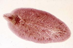 <p>A trematode parasite causing Liver Fluke Infection, transmitted via ingestion of contaminated water or vegetation, leading to liver damage and weight loss.</p>