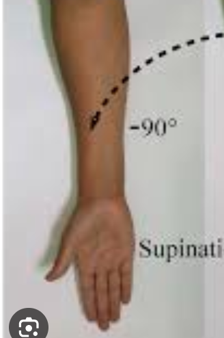 <p>palm faces anteriorly w/ radius and ulna parallel </p>