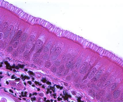 <p>what type of epithelial tissue is this?</p>