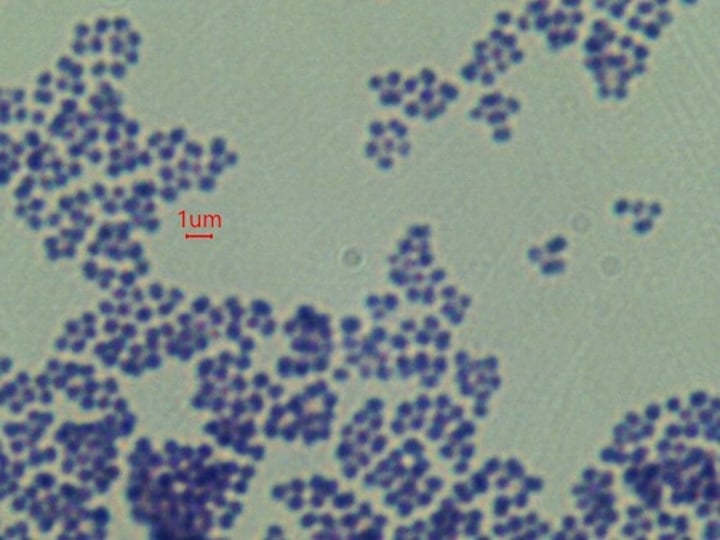 <p>What is the phylum of Staphylococcus epidermidis?</p>