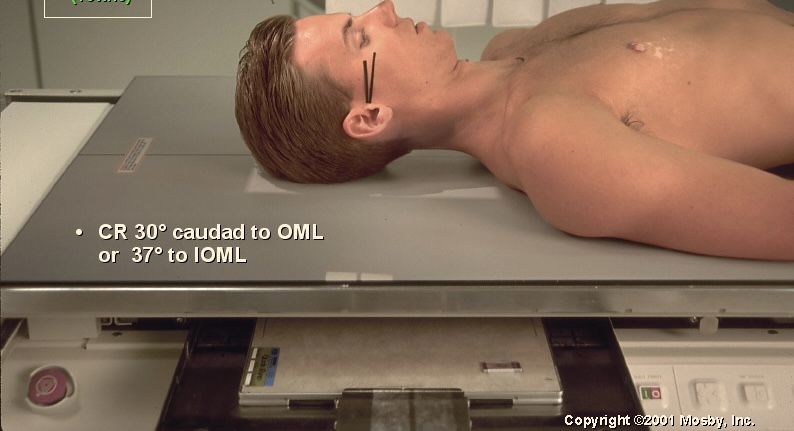 <p>What position is this?</p>