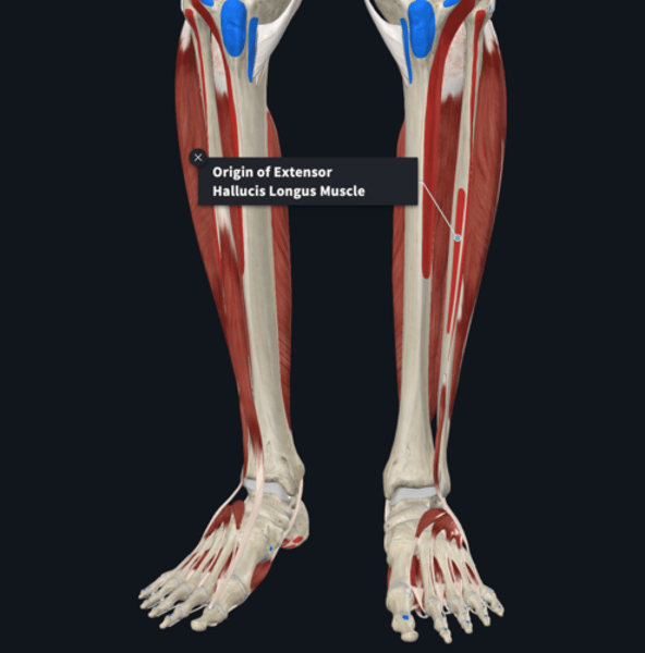 <p>Origin: extensor hallucis longus</p>