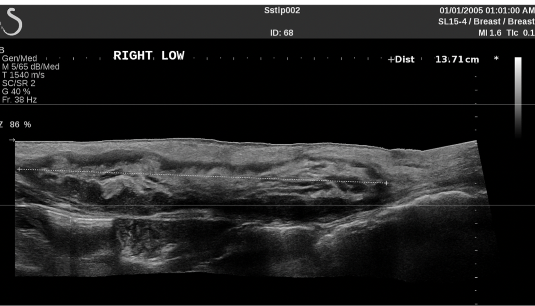 <p><strong>What is panoramic imaging in ultrasound, and how does it work?</strong></p>