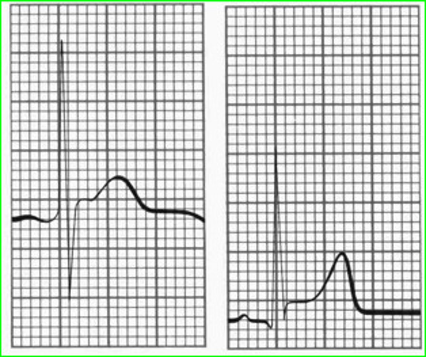 <p>v B2 to raise nâng cao This will ______ your status.</p>