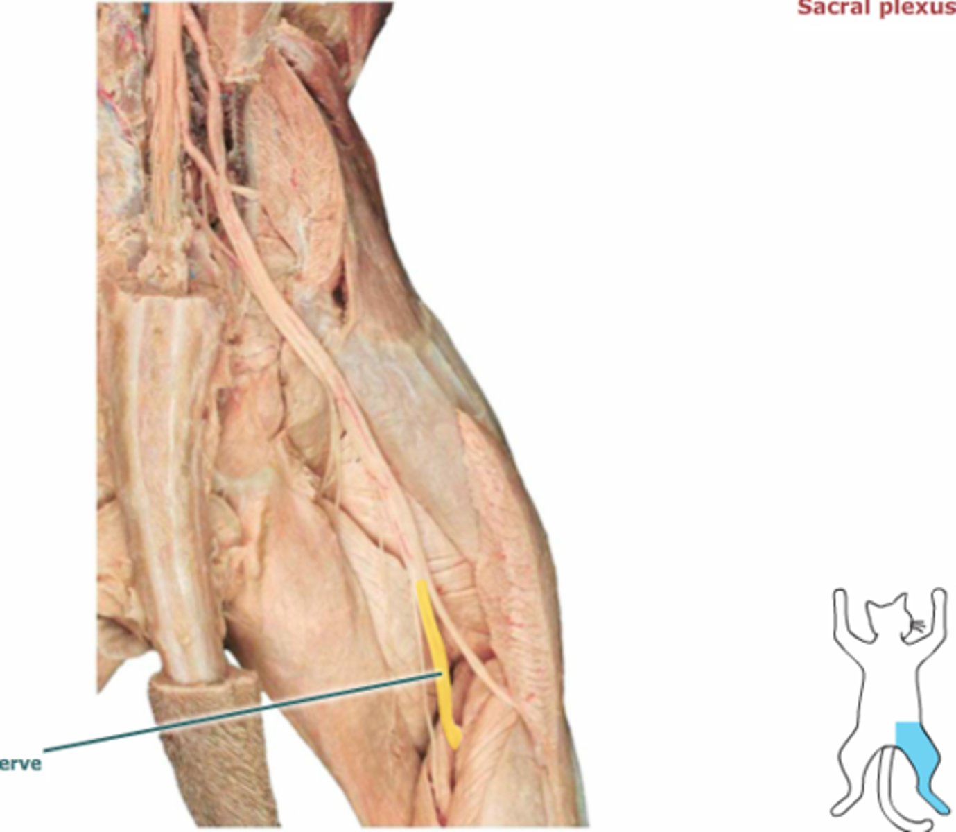 <p>What is the name of the yellow highlighted nerve?</p>