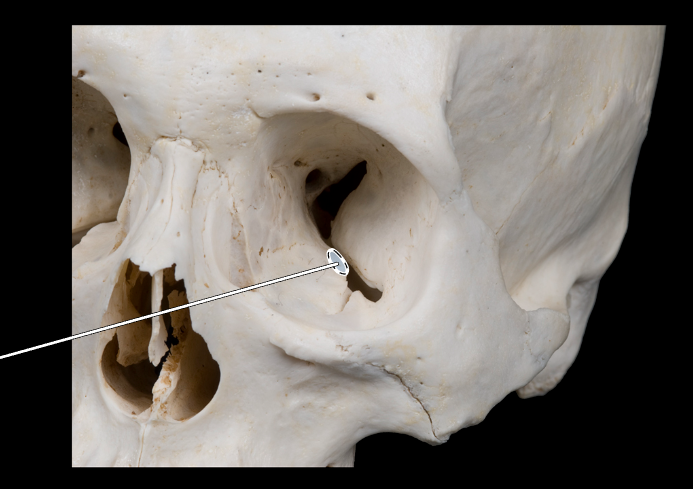 <p>Name this bone.</p><p>(Bones that form the orbit).</p>