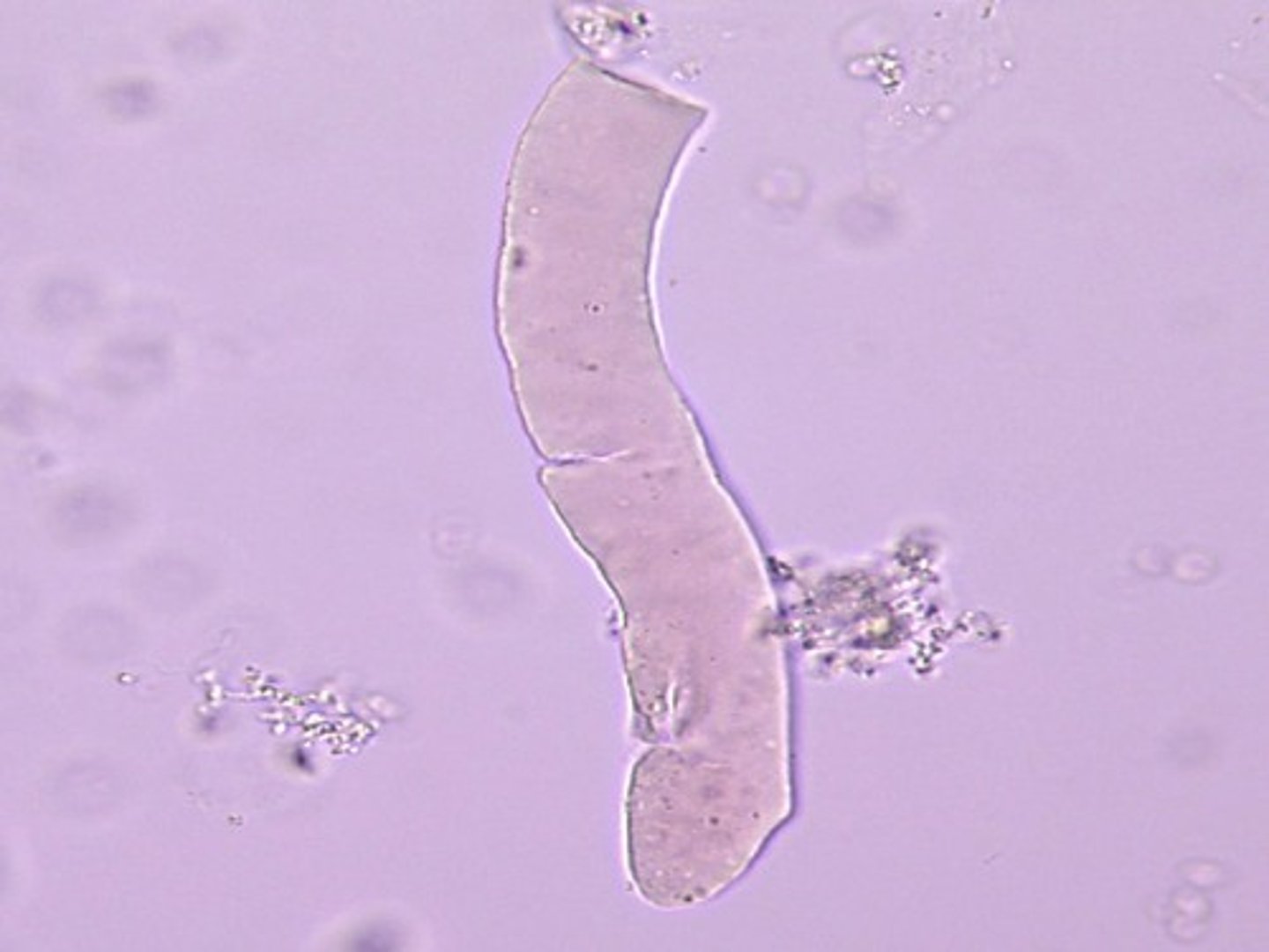 <p>appear as cylinders of smooth, highly refractile material. They are homogeneous with sharp, defined edges and usually squared-off ends. Cracks may occur within the cast, giving it a segmented appearance. Some believe ___ casts are the final stage of degeneration of the fine granules of granular casts. _____casts are seen in chronic renal failure and acute and chronic renal allograft rejection.</p>