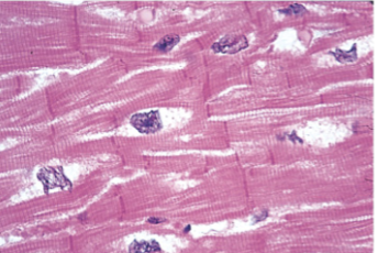 <p>Cardiac Muscle Tissue</p>