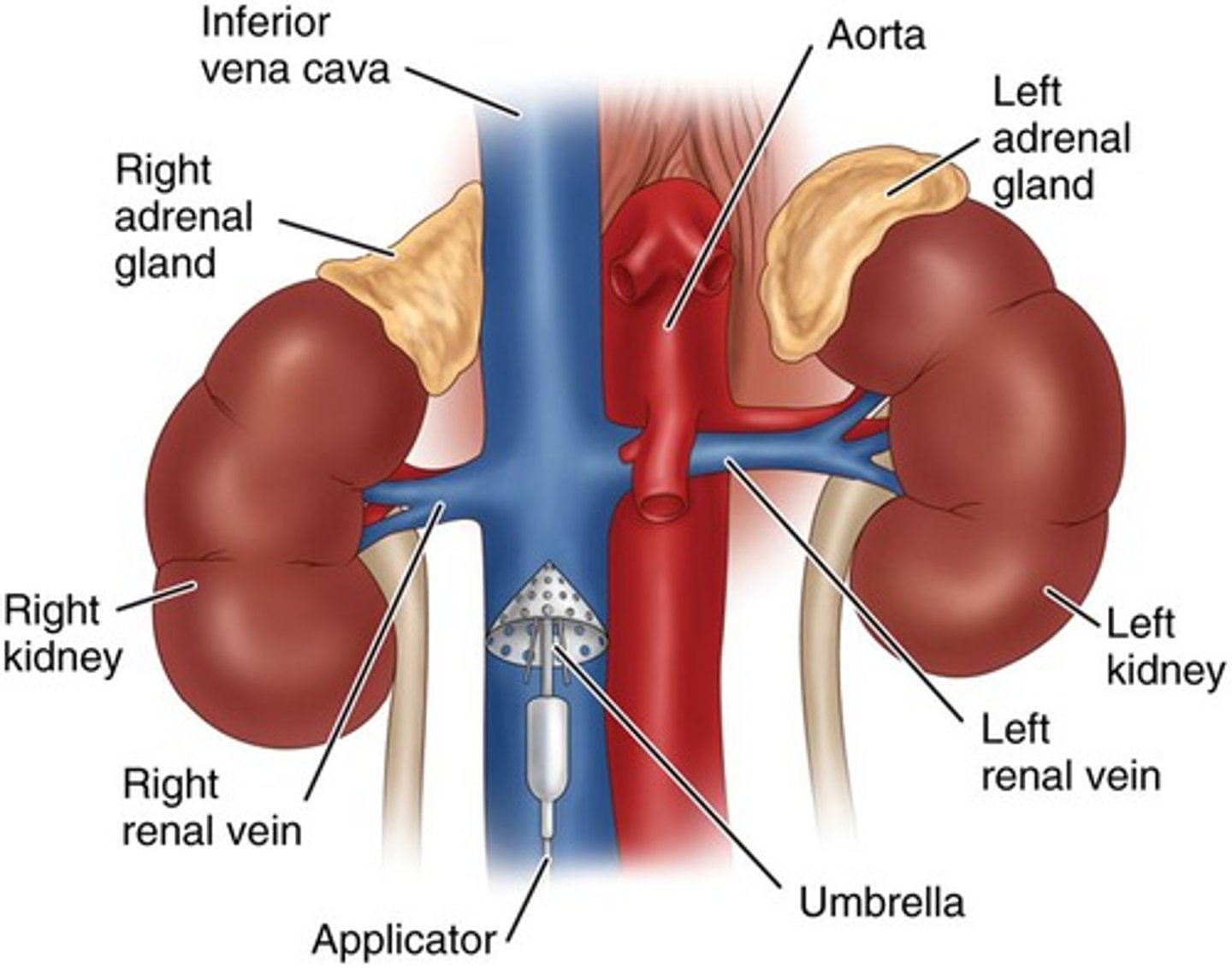 <p>- catch clots before they reach lungs</p><p>- used for people who can't be anticoagulated (oncology pts or if meds don't work)</p>